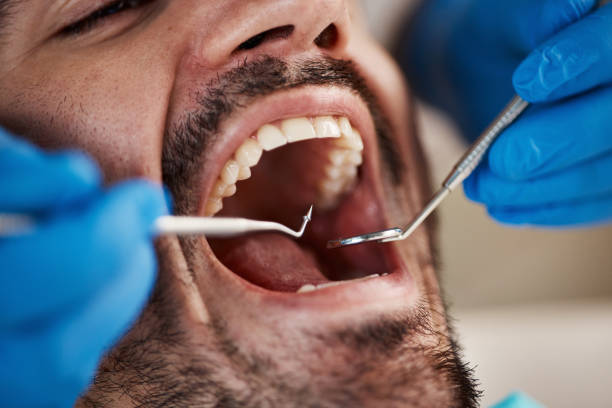 Best Dentist for Tooth Abscess  in Perryville, MO